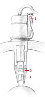 Detector Assembly
