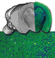 Mouse BIRN researchers are using multi-scale imaging methods to characterize mouse models of human neurological disorders