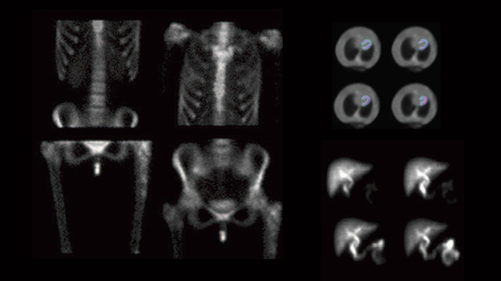 Photo of Digirad images